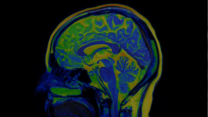 Foley Hoag Represents Lantheus Holdings in Its Acquisition of Cerveau Technologies Page